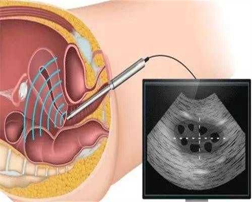 <strong>莆田试管助孕费用详解：13万能否满足助孕生子需求？</strong>
