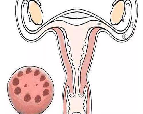 第三代试管婴儿费用解析及医院选择指南