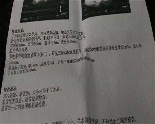 <strong>广州30岁卵巢早衰能做试管助孕吗？了解合法代生与代怀孕包成功几率</strong>