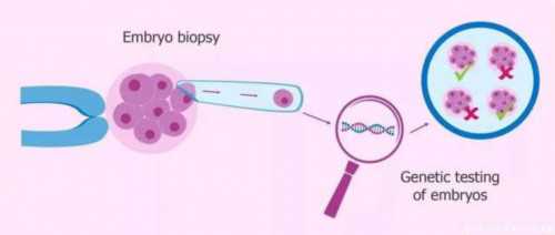 卵巢功能下降？深圳试管助孕助您圆梦，备受青睐的辅助生殖选择
