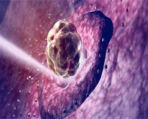 从准备到执行，有没有补助！