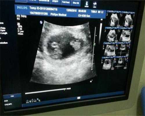 深圳正规助孕机构盘点，助您好孕之路！