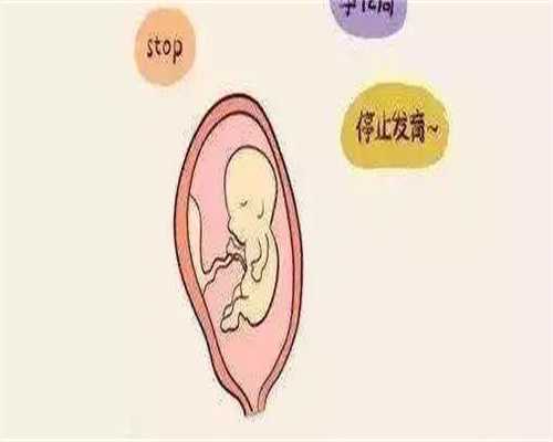 供卵助孕生儿子,输卵管积水试管需要处理吗？输卵管积水做试管婴儿方案