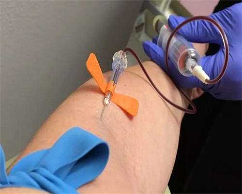 试管助孕是否会引发卵巢问题？